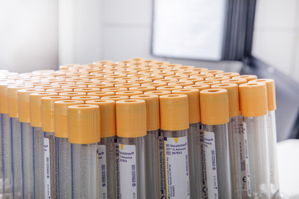 R&ouml;hrchen zur Blutentnahme