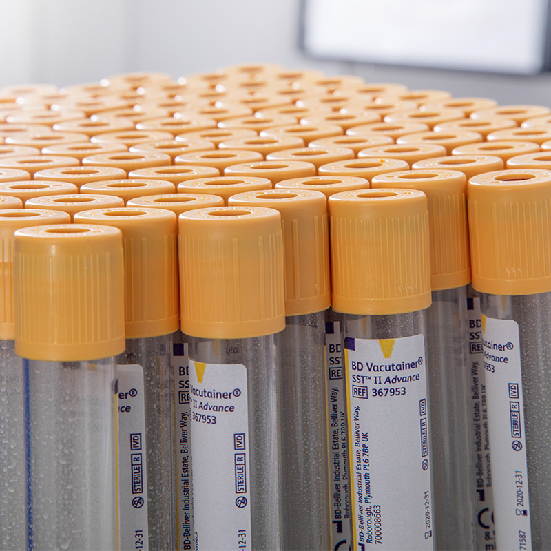 R&ouml;hrchen f&uuml;r die Blutentnahme