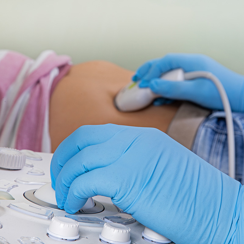 Ultraschalluntersuchung